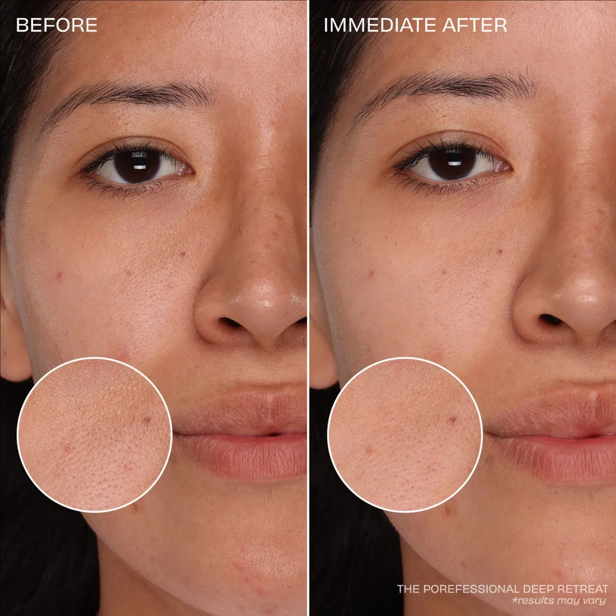 Benefit The Clear Necessities 2024 Pore Care Trial Set