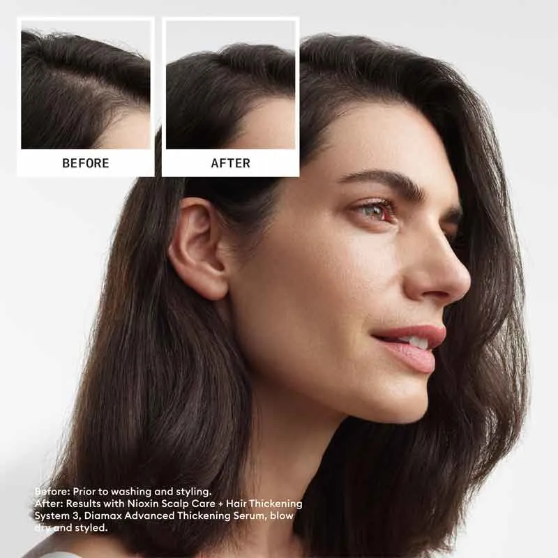 Nioxin System 3 Three Part Loyalty Kit